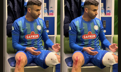 Çaykur Rizespor, Rachid Ghezzal’ın darbe alan ayağının fotoğrafını paylaştı