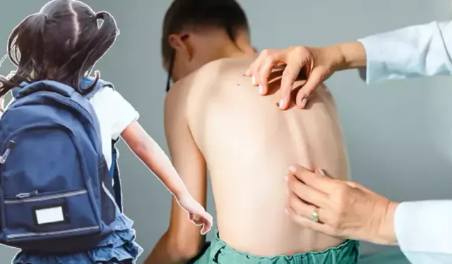 Ortopedi Uzmanı Dr. Yusuf Aşık’tan Uyarı: Tek Omuzda Çanta Taşımayın